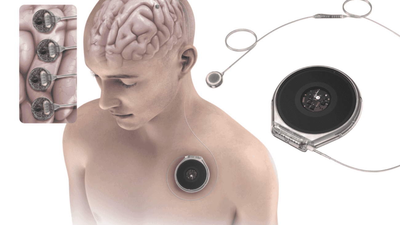 2-Paradromics-System-Medical-Illustration-1-of-2-1024x768
