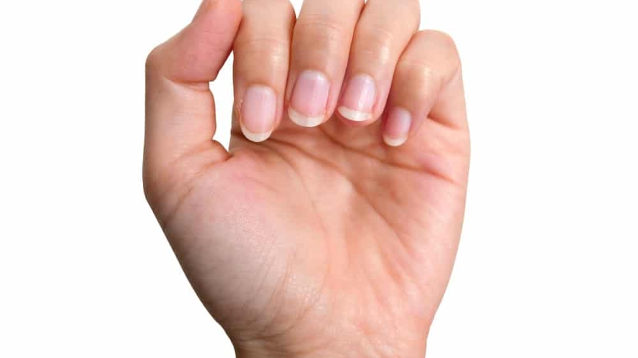 Unhas