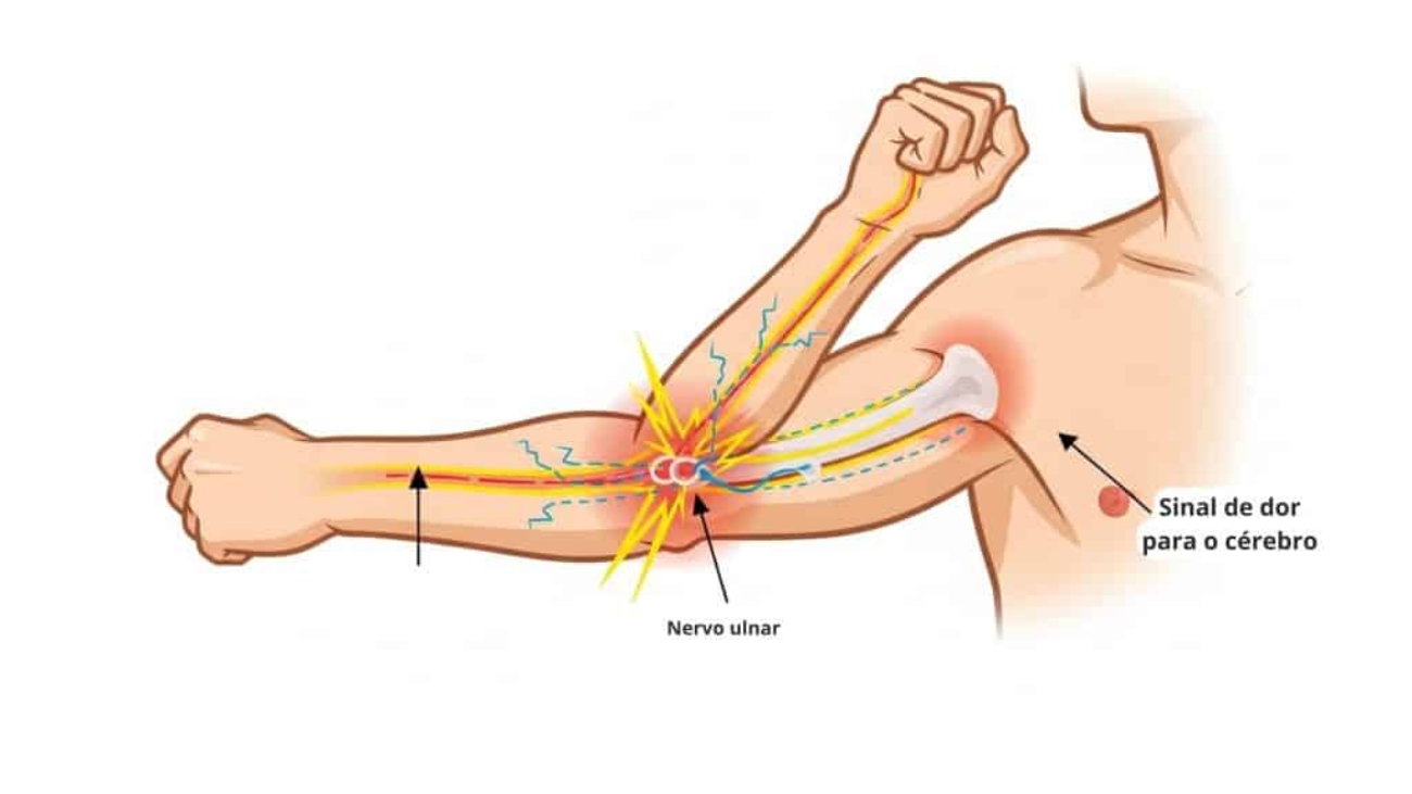 cotovelo-nervo-ulnar-8-1024x576